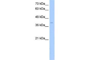 WB Suggested Anti-ZDHHC17 Antibody Titration:  5. (ZDHHC17 抗体  (Middle Region))