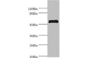 Western blot All lanes: CHIA antibody at 0. (CHIA 抗体  (AA 1-368))