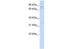 NEK11 antibody used at 1 ug/ml to detect target protein. (NEK11 抗体)