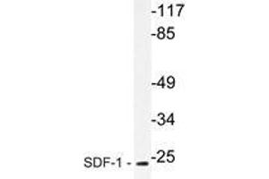 Western blot analysis of SDF-1 Antibody in extracts from HepG2 cells. (CXCL12 抗体)