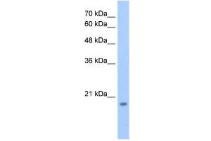 Western Blot showing DNTTIP1 antibody used at a concentration of 1-2 ug/ml to detect its target protein.