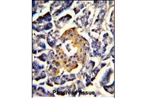 Immunohistochemistry (Paraffin-embedded Sections) (IHC (p)) image for anti-Signal Recognition Particle 72kDa (SRP72) (AA 119-148) antibody (ABIN390903)
