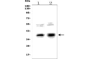 Western blot analysis of NHEJ1 using anti-NHEJ1 antibody (ABIN7599198).