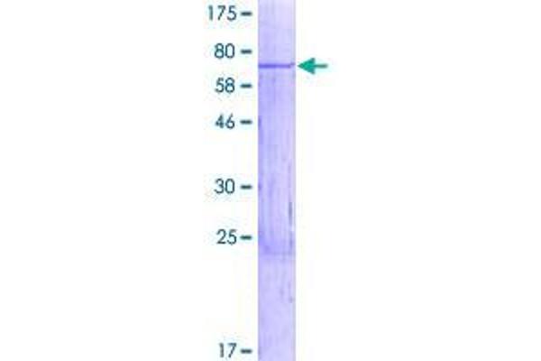 WBSCR16 Protein (AA 1-464) (GST tag)