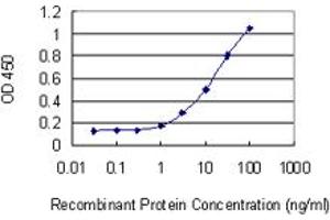 Detection limit for recombinant GST tagged DMD is 0. (Dystrophin 抗体  (AA 1-635))