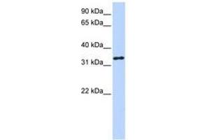 Image no. 1 for anti-3-hydroxyanthranilate 3,4-Dioxygenase (HAAO) (AA 72-121) antibody (ABIN6740761) (HAAO 抗体  (AA 72-121))
