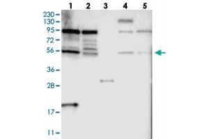 Western blot analysis of Lane 1: RT-4, Lane 2: U-251 MG, Lane 3: Human Plasma, Lane 4: Liver, Lane 5: Tonsil with TOX4 polyclonal antibody  at 1:250-1:500 dilution. (TOX4 抗体)