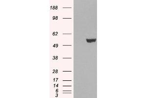 Western Blotting (WB) image for anti-Interferon Regulatory Factor 6 (IRF6) antibody (ABIN5869219) (IRF6 抗体)