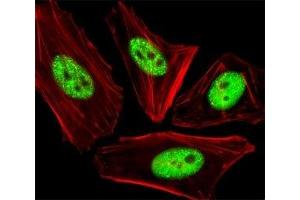 Fluorescent image of HeLa cells stained with phospho-CDC25A antibody at 1:25 dilution. (CDC25A 抗体  (pThr507))