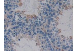 Immunohistochemistry (IHC) image for anti-serpin Peptidase Inhibitor, Clade A (Alpha-1 Antiproteinase, Antitrypsin), Member 10 (SERPINA10) (AA 22-448) antibody (ABIN7434530)