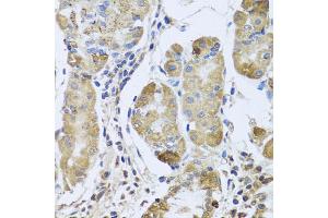 Immunohistochemistry of paraffin-embedded human stomach using EFHC1 antibody. (EFHC1 抗体)