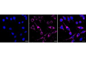 Immunocytochemical staining of HepG2 cells with SEC61A1/2 antibody (ABIN7800968), 1:1,000). (Recombinant SEC61A1/2 抗体)