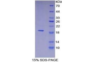 SDS-PAGE of Protein Standard from the Kit  (Highly purified E. (Thrombomodulin ELISA 试剂盒)