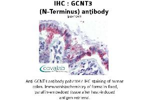 Image no. 2 for anti-Glucosaminyl (N-Acetyl) Transferase 3, Mucin Type (GCNT3) (N-Term) antibody (ABIN1734656) (GCNT3 抗体  (N-Term))
