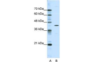 WB Suggested Anti-DOK2 Antibody Titration:  0. (DOK2 抗体  (C-Term))