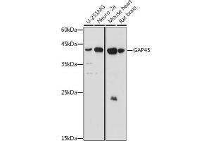 Western blot analysis of extracts of various cell lines, using G antibody (ABIN6127469, ABIN6140954, ABIN6140955 and ABIN6221997) at 1:1000 dilution. (GAP43 抗体  (AA 1-238))