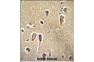 Immunohistochemistry (Paraffin-embedded Sections) (IHC (p)) image for anti-Corticotropin Releasing Hormone Receptor 2 (CRHR2) (AA 10-39) antibody (ABIN655389)