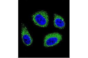 Confocal immunofluorescent analysis of DHCR7 Antibody (C-term) (ABIN655399 and ABIN2844946) with MCF-7 cell followed by Alexa Fluor 488-conjugated goat anti-rabbit lgG (green).