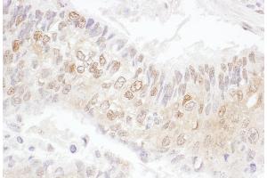 Immunohistochemistry (IHC) image for anti-Cyclin-Dependent Kinase 4 (CDK4) (AA 253-303) antibody (ABIN7455013) (CDK4 抗体  (AA 253-303))