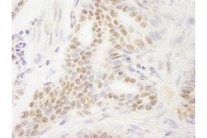 anti-DEK Oncogene (DEK) (AA 225-275) antibody