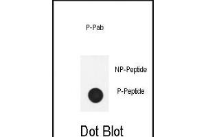 Dot blot analysis of anti-Phospho-Nephrin  antibody Phospho-specific Pab (ABIN650884 and ABIN2839827) on nitrocellulose membrane. (Nephrin 抗体  (pTyr1210))