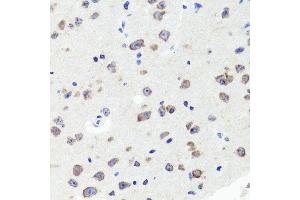 Immunohistochemistry of paraffin-embedded mouse brain using DLG1 antibody (ABIN5996451) at dilution of 1/100 (40x lens). (DLG1 抗体)