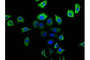Immunofluorescence staining of A549 cells with ABIN7161414 at 1:166, counter-stained with DAPI. (NPY2R 抗体  (AA 326-381))