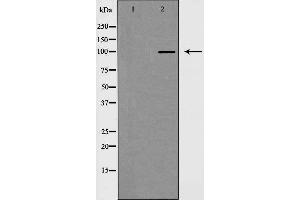 Western blot analysis of extracts from HeLa cells using MKL1 antibody. (MKL1 抗体  (N-Term))
