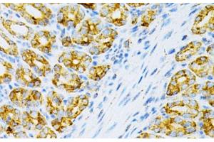 Immunohistochemistry of paraffin-embedded Mouse intestine using OLR1 Polyclonal Antibody at dilution of 1:200 (40x lens). (OLR1 抗体)
