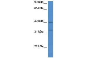 Western Blot showing MTNR1A antibody used at a concentration of 1 ug/ml against Jurkat Cell Lysate (Melatonin Receptor 1A 抗体  (C-Term))