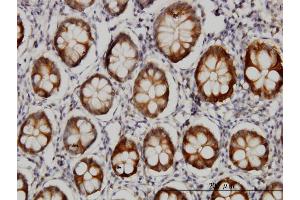 Immunoperoxidase of monoclonal antibody to AKR1B10 on formalin-fixed paraffin-embedded human colon.