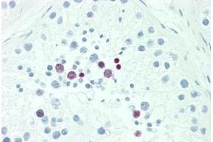 anti-POU Class 5 Homeobox 1B (POU5F1B) (AA 214-242) antibody