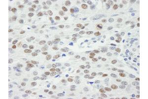 Immunohistochemistry (IHC) image for anti-Mdc1 (MDC1) (AA 1375-1425) antibody (ABIN7448658) (MDC1 抗体  (AA 1375-1425))