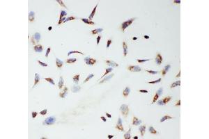 ICC testing of TFAM antibody and HeLa cells (TFAM 抗体  (C-Term))
