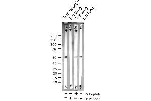 Western blot analysis of Phospho-GSK3 alpha (Ser21) expression in various lysates (GSK3 alpha 抗体  (pSer21))