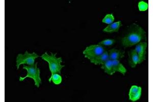 Immunofluorescent analysis of MCF-7 cells using ABIN7162218 at dilution of 1:100 and Alexa Fluor 488-congugated AffiniPure Goat Anti-Rabbit IgG(H+L) (Oncostatin M Receptor 抗体  (AA 120-193))