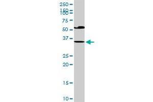 EDA2R MaxPab rabbit polyclonal antibody. (Ectodysplasin A2 Receptor 抗体  (AA 1-297))