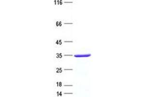 Western Blotting (WB) image for Growth Factor Independent 1B Transcription Repressor (GFI1B) protein (His tag) (ABIN5505652)