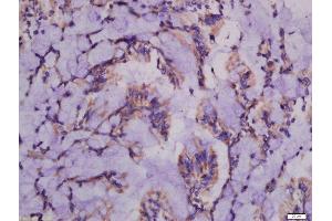 Formalin-fixed and paraffin embedded rat intestine labeled with Anti-ATG101 Polyclonal Antibody, Unconjugated  at 1:300 followed by conjugation to the secondary antibody and DAB staining. (ATG101 抗体  (AA 121-218))