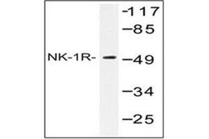 Image no. 1 for anti-Tachykinin Receptor 1 (TACR1) antibody (ABIN317654) (TACR1 抗体)