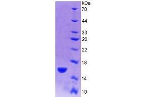SDS-PAGE analysis of Rat R-Spondin 1 Protein. (RSPO1 蛋白)