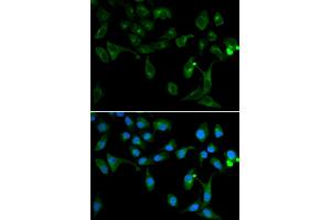 Immunofluorescence analysis of U2OS cells using TOLLIP antibody. (TOLLIP 抗体)