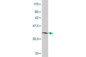 Western Blot detection against Immunogen (35. (SLC2A4RG 抗体  (AA 178-269))