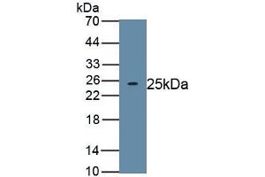 Detection of Recombinant TITF1, Human using Polyclonal Antibody to Thyroid Transcription Factor 1 (TITF1) (NKX2-1 抗体)