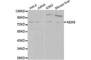 Western blot analysis of extracts of various cell lines, using NEK8 antibody (ABIN5970372) at 1/1000 dilution. (NEK8 抗体)