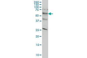 Western Blotting (WB) image for anti-serine/threonine Kinase 33 (STK33) (AA 1-514) antibody (ABIN566310)