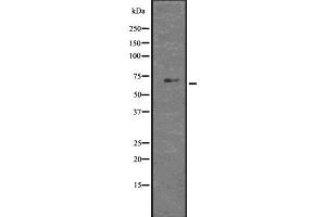 Western blot analysis of GLIS1 using HT29 whole  lysates. (GLIS1 抗体  (N-Term))