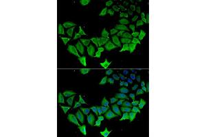 Immunofluorescence analysis of HeLa cell using APLP1 antibody. (APLP1 抗体)