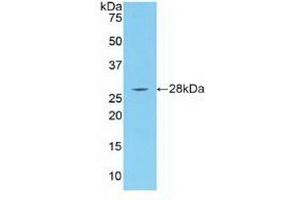 Western blot analysis of recombinant Human IRAK4. (IRAK4 抗体  (AA 189-427))