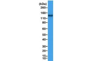 Western blot testing of human Jurkat cell lysate with recombinant CD31 antibody at 1:1000.